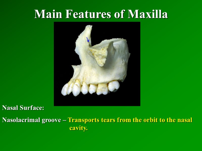 Main Features of Maxilla   Nasal Surface: Nasolacrimal groove – Transports tears from